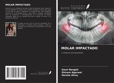 Buchcover von MOLAR IMPACTADO