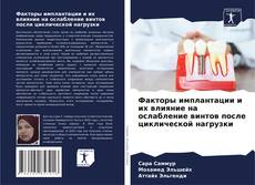 Bookcover of Факторы имплантации и их влияние на ослабление винтов после циклической нагрузки
