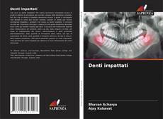 Bookcover of Denti impattati