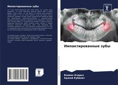 Bookcover of Импактированные зубы