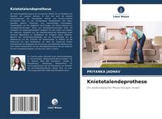 Bookcover of Knietotalendoprothese