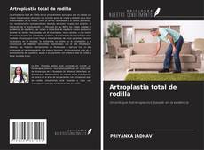 Buchcover von Artroplastia total de rodilla