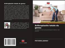 Borítókép a  Arthroplastie totale du genou - hoz
