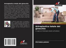 Artroplastica totale del ginocchio的封面