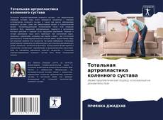 Bookcover of Тотальная артропластика коленного сустава