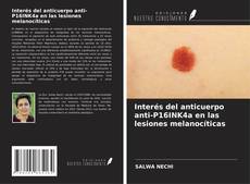 Capa do livro de Interés del anticuerpo anti-P16INK4a en las lesiones melanocíticas 