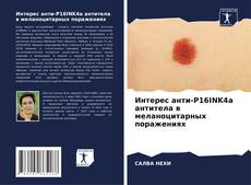 Copertina di Интерес анти-P16INK4a антитела в меланоцитарных поражениях