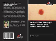 Couverture de Interesse dell'anticorpo anti-P16INK4a nelle lesioni melanocitarie