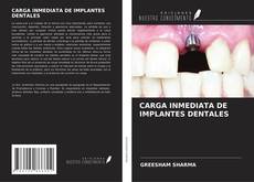CARGA INMEDIATA DE IMPLANTES DENTALES的封面