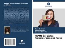 Buchcover von PRAME bei oralen Präkanzerosen und Krebs