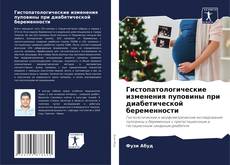 Bookcover of Гистопатологические изменения пуповины при диабетической беременности