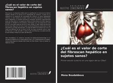 Bookcover of ¿Cuál es el valor de corte del fibroscan hepático en sujetos sanos?