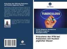 Bookcover of Prävalenz der PTB bei Patienten mit Husten jeglicher Dauer