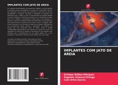 IMPLANTES COM JATO DE AREIA kitap kapağı