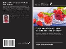 Bookcover of Endocarditis infecciosa aislada del lado derecho