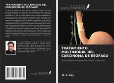 TRATAMIENTO MULTIMODAL DEL CARCINOMA DE ESÓFAGO kitap kapağı