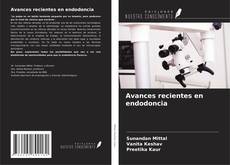 Bookcover of Avances recientes en endodoncia