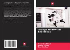 Buchcover von Avanços recentes na Endodontia