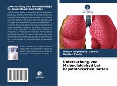 Bookcover of Untersuchung von Malondialdehyd bei hepatotoxischen Ratten
