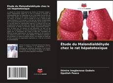 Bookcover of Étude du Malondialdéhyde chez le rat hépatotoxique