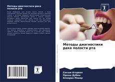 Buchcover von Методы диагностики рака полости рта