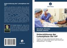 Capa do livro de Unterstützung der Lutealphase bei IVF 