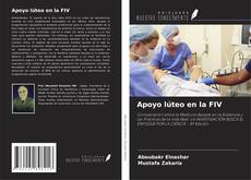 Bookcover of Apoyo lúteo en la FIV