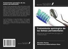 Capa do livro de Tratamiento quirúrgico de las bolsas periodontales 