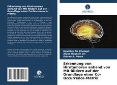 Portada del libro de Erkennung von Hirntumoren anhand von MR-Bildern auf der Grundlage einer Co-Occurrence-Matrix