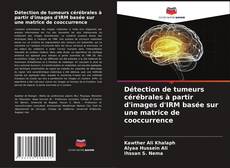 Buchcover von Détection de tumeurs cérébrales à partir d'images d'IRM basée sur une matrice de cooccurrence