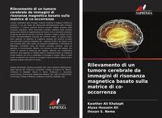 Capa do livro de Rilevamento di un tumore cerebrale da immagini di risonanza magnetica basato sulla matrice di co-occorrenza 