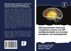 Borítókép a  Обнаружение опухоли головного мозга на МР-изображениях на основе матрицы ко-совпадений - hoz