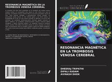 RESONANCIA MAGNÉTICA EN LA TROMBOSIS VENOSA CEREBRAL kitap kapağı