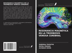 RESONANCIA MAGNÉTICA EN LA TROMBOSIS VENOSA CEREBRAL的封面