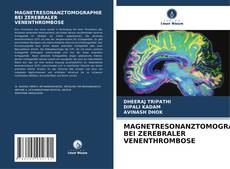 Buchcover von MAGNETRESONANZTOMOGRAPHIE BEI ZEREBRALER VENENTHROMBOSE