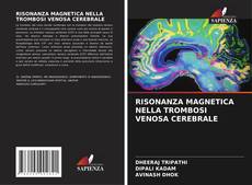 RISONANZA MAGNETICA NELLA TROMBOSI VENOSA CEREBRALE kitap kapağı