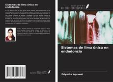 Buchcover von Sistemas de lima única en endodoncia
