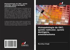 Buchcover von Histopatología de OKC, quiste radicular, quiste dentígero, ameloblastoma