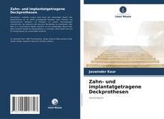 Обложка Zahn- und implantatgetragene Deckprothesen