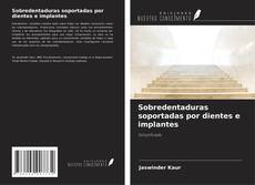 Bookcover of Sobredentaduras soportadas por dientes e implantes