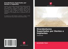 Copertina di Overdentures Suportadas por Dentes e Implantes