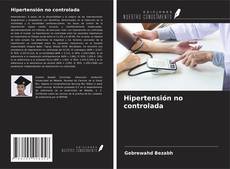 Bookcover of Hipertensión no controlada