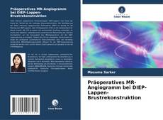 Präoperatives MR-Angiogramm bei DIEP-Lappen-Brustrekonstruktion的封面