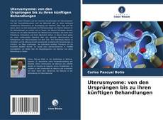 Portada del libro de Uterusmyome: von den Ursprüngen bis zu ihren künftigen Behandlungen