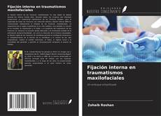 Buchcover von Fijación interna en traumatismos maxilofaciales