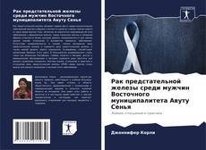Buchcover von Рак предстательной железы среди мужчин Восточного муниципалитета Авуту Сенья