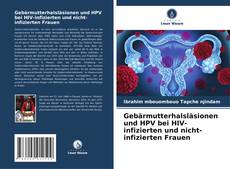 Buchcover von Geb?rmutterhalsl?sionen und HPV bei HIV-infizierten und nicht-infizierten Frauen