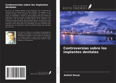 Controversias sobre los implantes dentales kitap kapağı