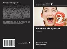 Capa do livro de Periodontitis agresiva 