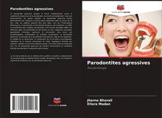 Capa do livro de Parodontites agressives 